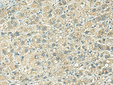 KLC2 Polyclonal Antibody Reactivity Human