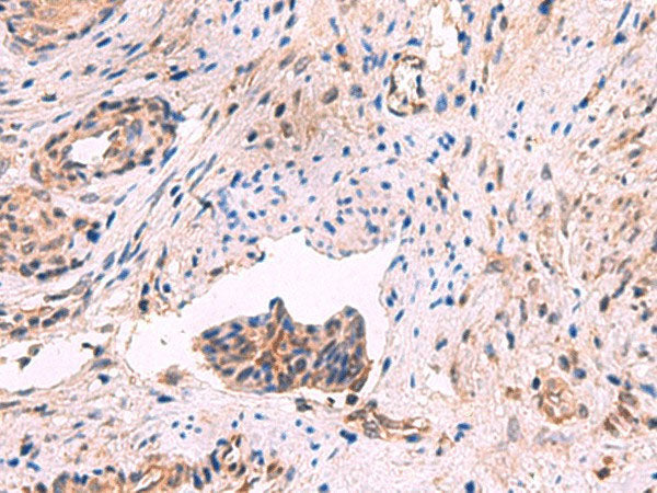 GSPT2 Polyclonal Antibody Reactivity Human
