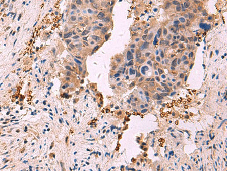 SHC4 Polyclonal Antibody Reactivity Human
