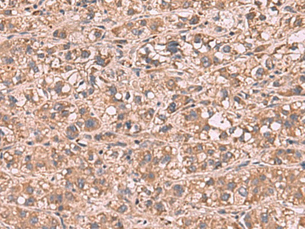 SHC4 Polyclonal Antibody Reactivity Human