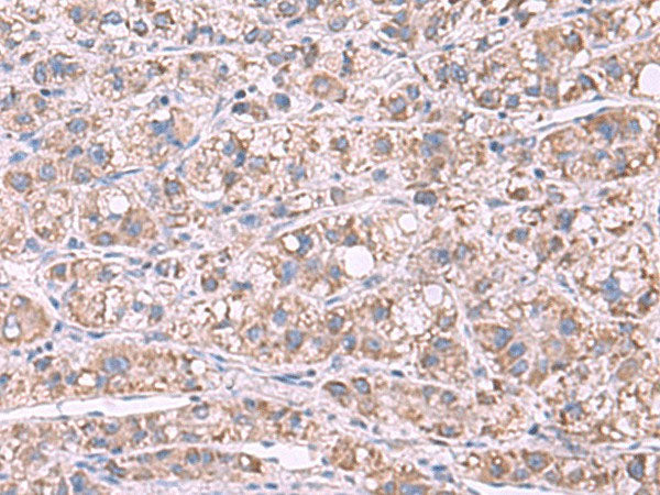 GSTCD Polyclonal Antibody Reactivity Human