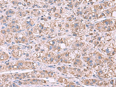 GSTCD Polyclonal Antibody Reactivity Human