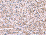 GSTCD Polyclonal Antibody Reactivity Human