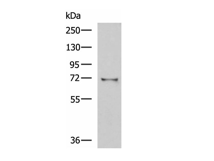 GSTCD Polyclonal Antibody Reactivity Human