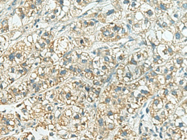 SORBS2 Polyclonal Antibody Reactivity Human
