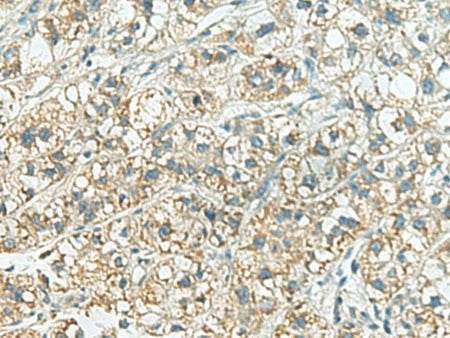 SORBS2 Polyclonal Antibody Reactivity Human