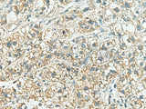 SORBS2 Polyclonal Antibody Reactivity Human