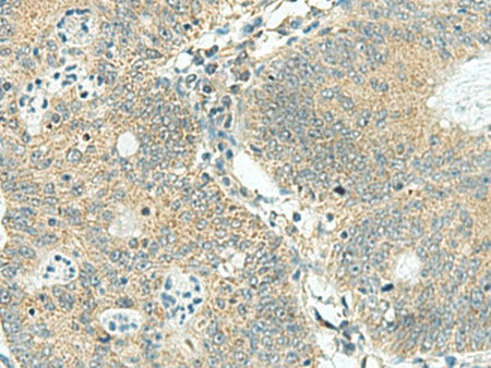SORBS2 Polyclonal Antibody Reactivity Human