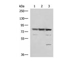 SORBS2 Polyclonal Antibody Reactivity Human