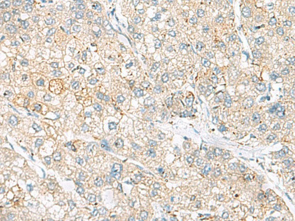 FARP2 Polyclonal Antibody Reactivity Human
