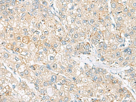 FARP2 Polyclonal Antibody Reactivity Human