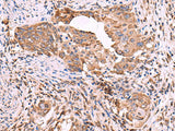 EEF1D Polyclonal Antibody Reactivity Human