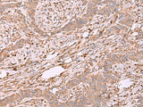 EEF1D Polyclonal Antibody Reactivity Human