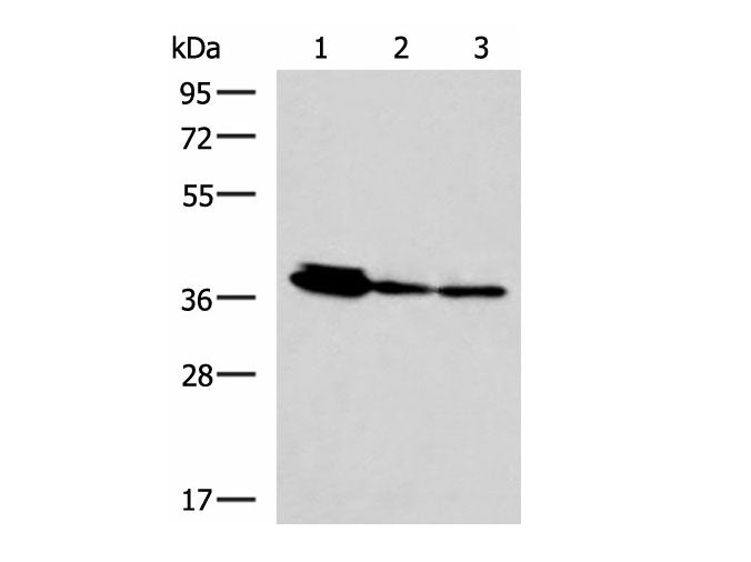 EEF1D Polyclonal Antibody Reactivity Human