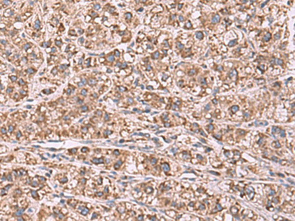 GUSB Polyclonal Antibody Reactivity Human