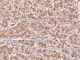 GUSB Polyclonal Antibody Reactivity Human