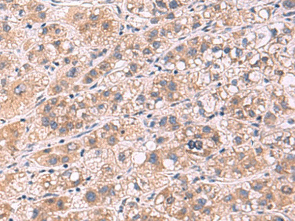 PPEF1 Polyclonal Antibody Reactivity Human | Elabscience Biotechnology