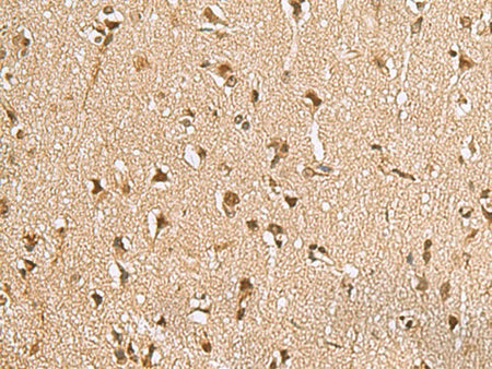 NVL Polyclonal Antibody Reactivity Human