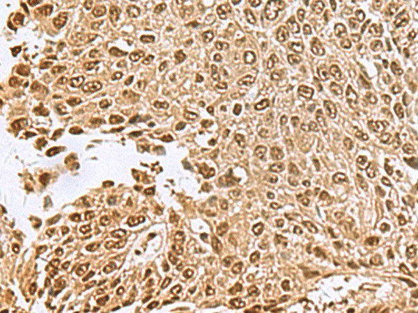 NVL Polyclonal Antibody Reactivity Human