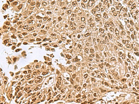 NVL Polyclonal Antibody Reactivity Human