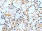 GPCPD1 Polyclonal Antibody Reactivity Human