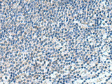 KIF2A Polyclonal Antibody Reactivity Human
