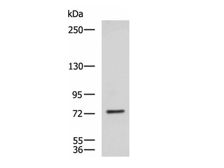 KIF2A Polyclonal Antibody Reactivity Human
