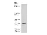 KIF2A Polyclonal Antibody Reactivity Human