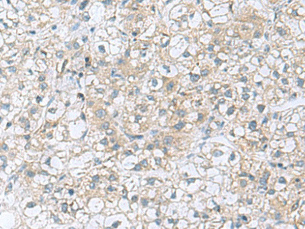 TRO Polyclonal Antibody Reactivity Human