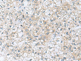 TRO Polyclonal Antibody Reactivity Human