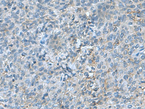 SRPK2 Polyclonal Antibody Reactivity Human