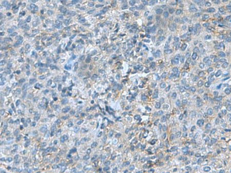 SRPK2 Polyclonal Antibody Reactivity Human