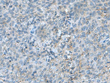 SRPK2 Polyclonal Antibody Reactivity Human
