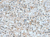 CNTN4 Polyclonal Antibody Reactivity Human