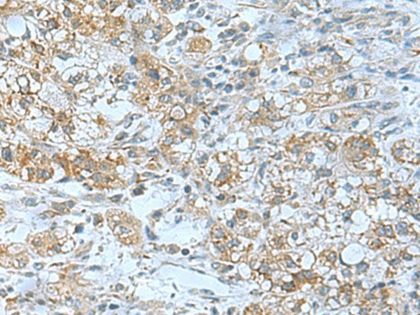 TSGA10 Polyclonal Antibody