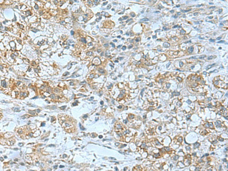 TSGA10 Polyclonal Antibody