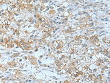 TSGA10 Polyclonal Antibody