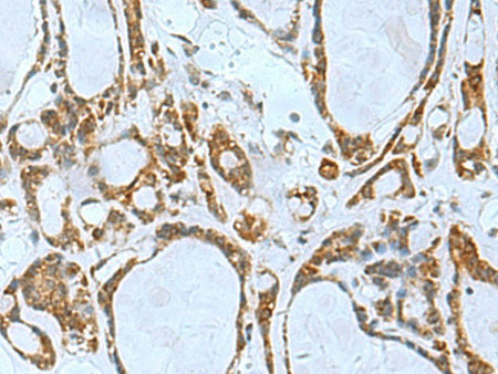 TSGA10 Polyclonal Antibody