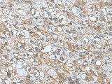KANSL1L Polyclonal Antibody Reactivity Human