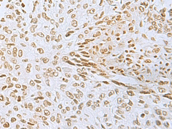 L3MBTL2 Polyclonal Antibody Reactivity Human