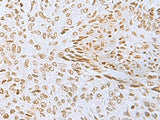 L3MBTL2 Polyclonal Antibody Reactivity Human