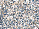 IP6K2 Polyclonal Antibody Reactivity Human