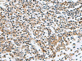 AP1S3 Polyclonal Antibody Reactivity Human