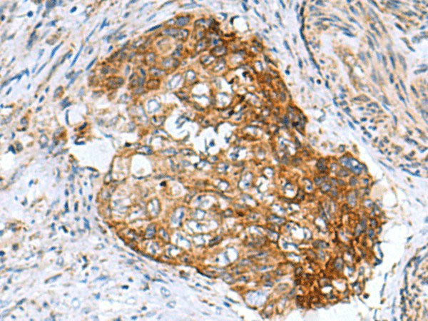 AP1S3 Polyclonal Antibody Reactivity Human