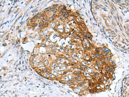 AP1S3 Polyclonal Antibody Reactivity Human