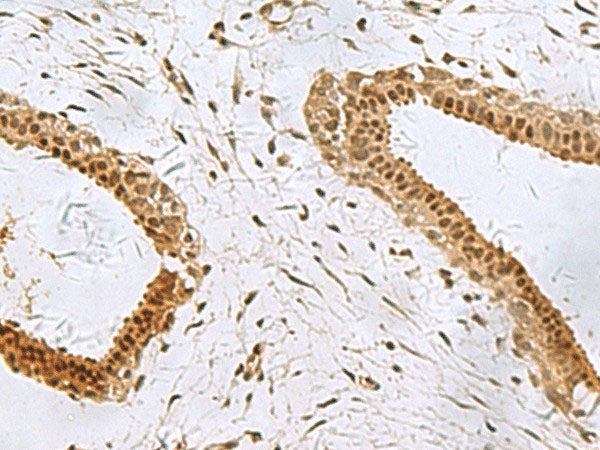 PCBD1 Polyclonal Antibody Reactivity Human