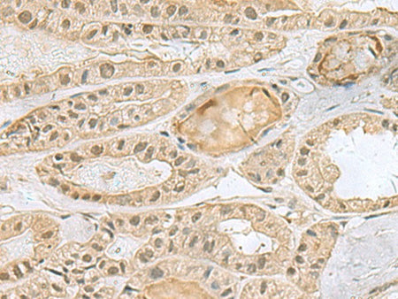PCBD1 Polyclonal Antibody Reactivity Human