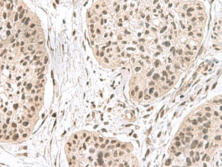 ERH Polyclonal Antibody Reactivity Human