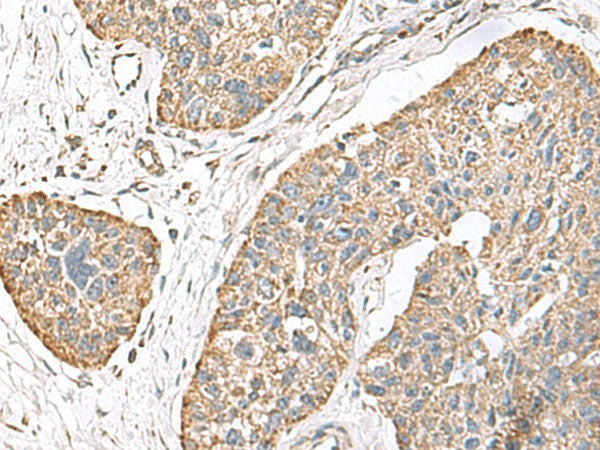 TMEM141 Polyclonal Antibody Reactivity Human