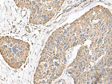 TMEM141 Polyclonal Antibody Reactivity Human